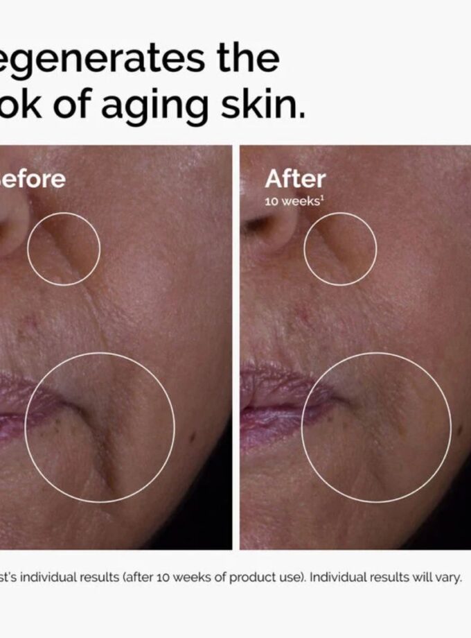 The Ordinary GF 15% Solution 30ml