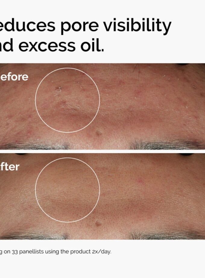 The Ordinary Niacinamide 10% + Zinc 1% Serum